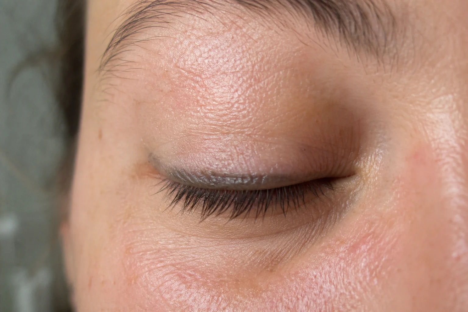 A permanent-eyeliner cosmetic tattoo