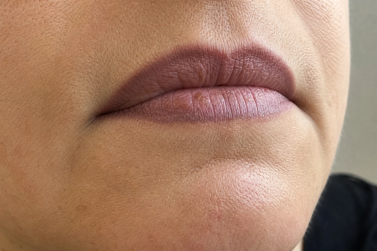 A lip-blush cosmetic tattoo