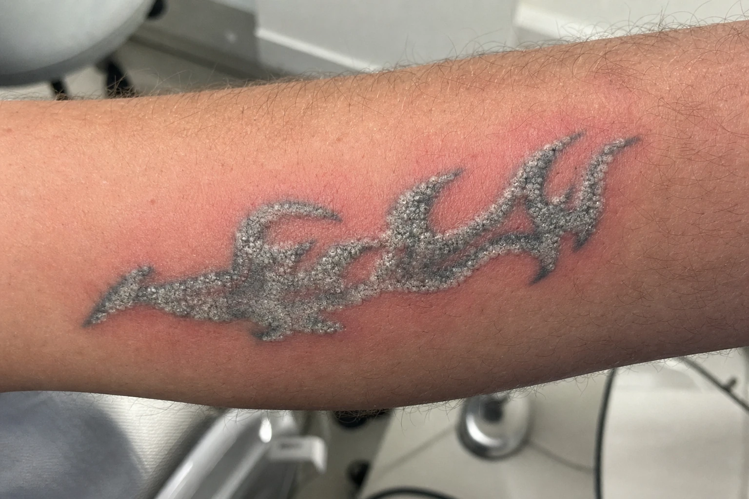 The temporary white 'frosting' seconds after a laser pulse