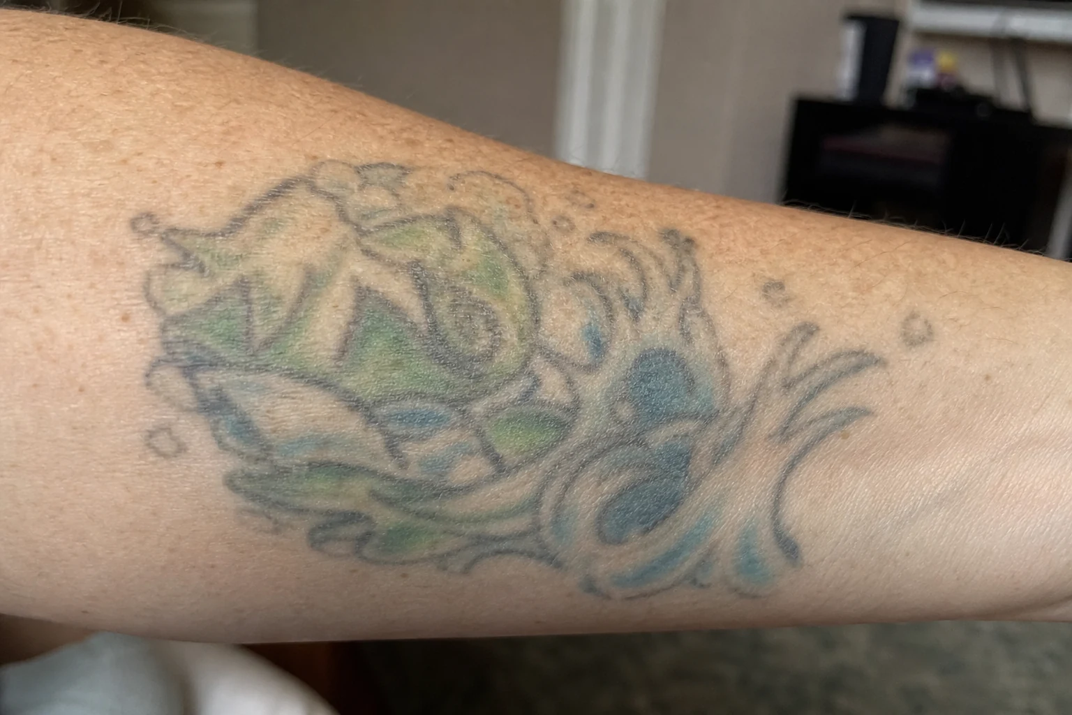 A green tattoo — one of the harder colours to clear