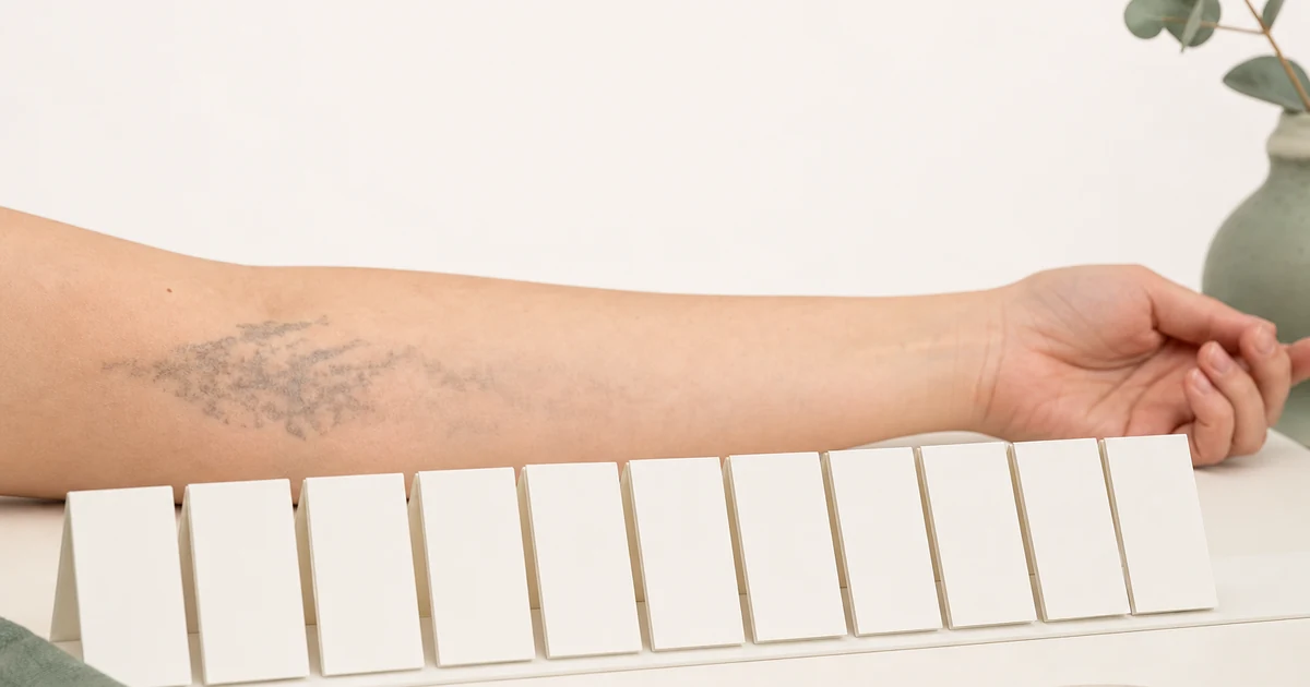 Cover: How Long Does Tattoo Removal Really Take, Start to Finish? — Tattoo Removal Guide