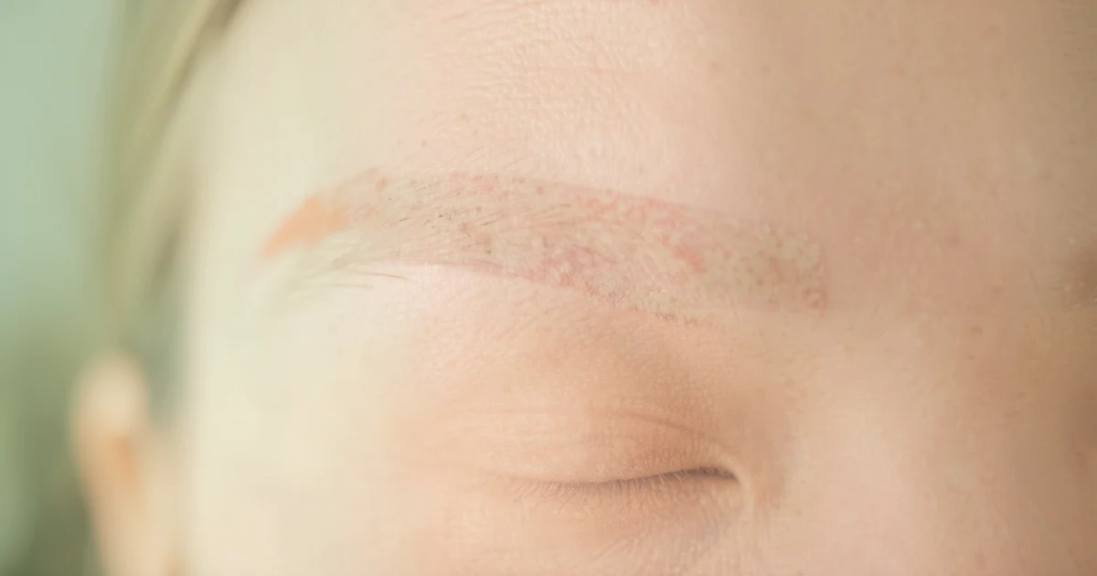 Removing Old or Faded Permanent Makeup: The Discolouration Problem (2026) — an independent, data-backed guide from Tattoo Removal Guide