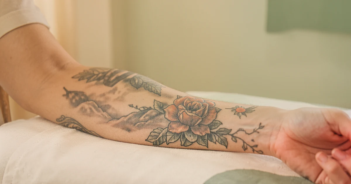 Cover: One Large Tattoo vs Several Small Ones โ Tattoo Removal Guide