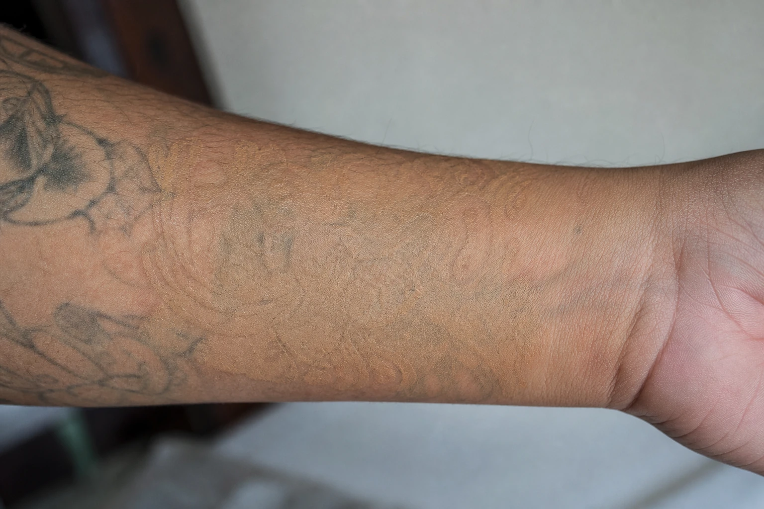 Flesh-toned cover ink can be unpredictable to remove