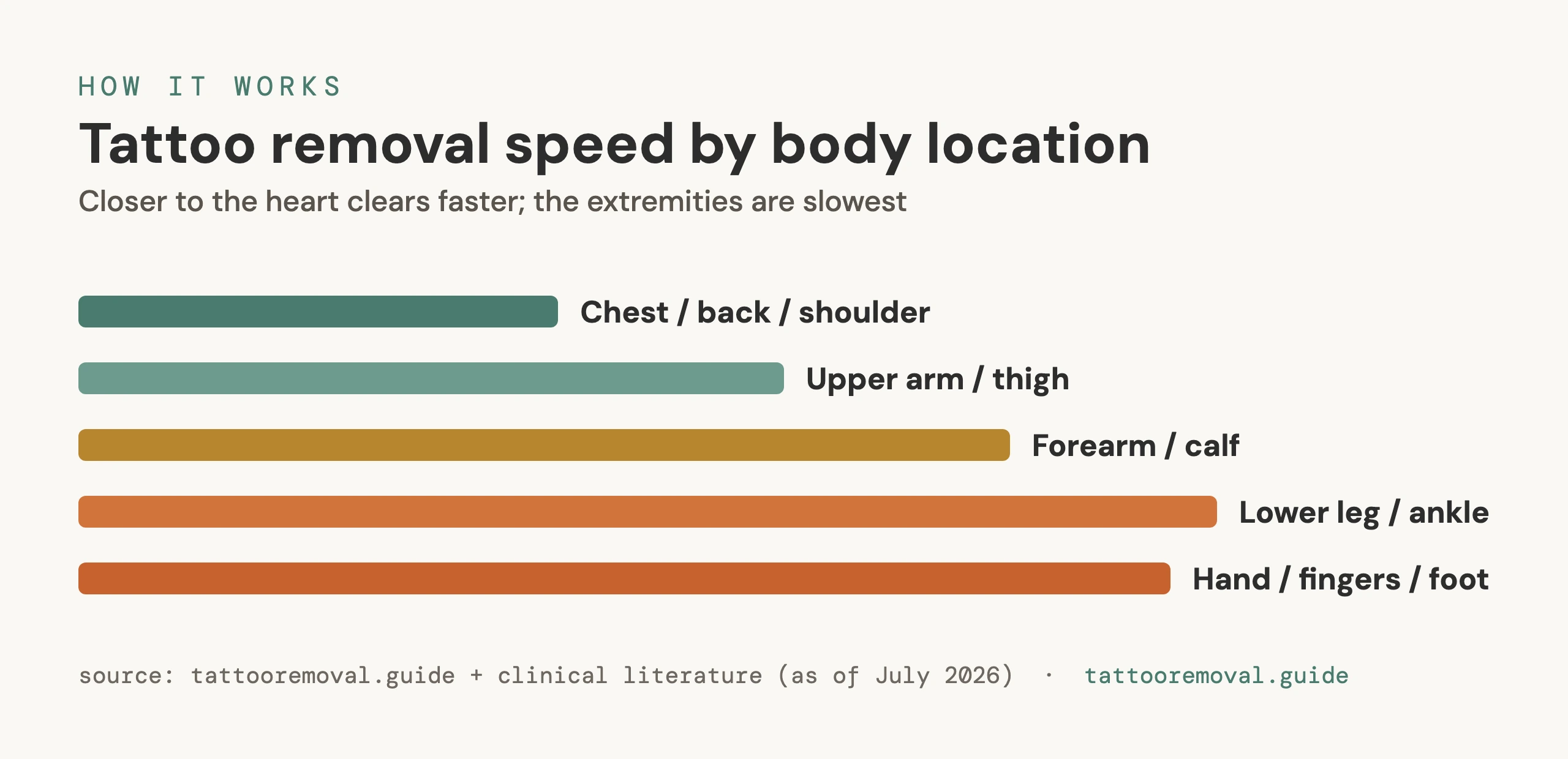 Bar chart ranking tattoo removal speed by body area, from chest and shoulder (fastest) to hands and feet (slowest).