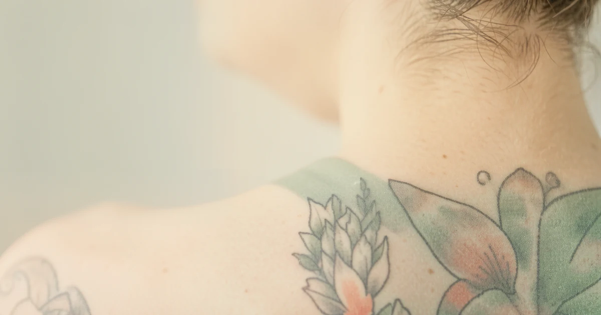 Cover: Tattoo Removal on the Face, Neck and Visible Areas β Tattoo Removal Guide