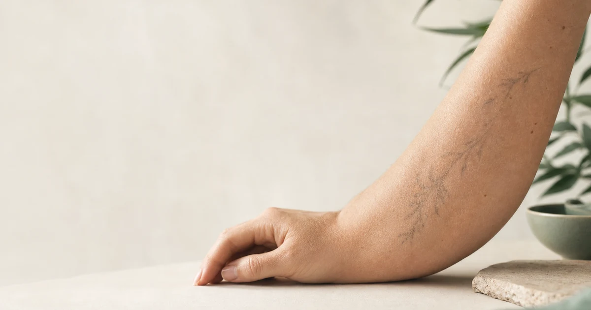 Cover: Will Tattoo Removal Scar? Real Risks and How Good Clinics Minimise — Tattoo Removal Guide