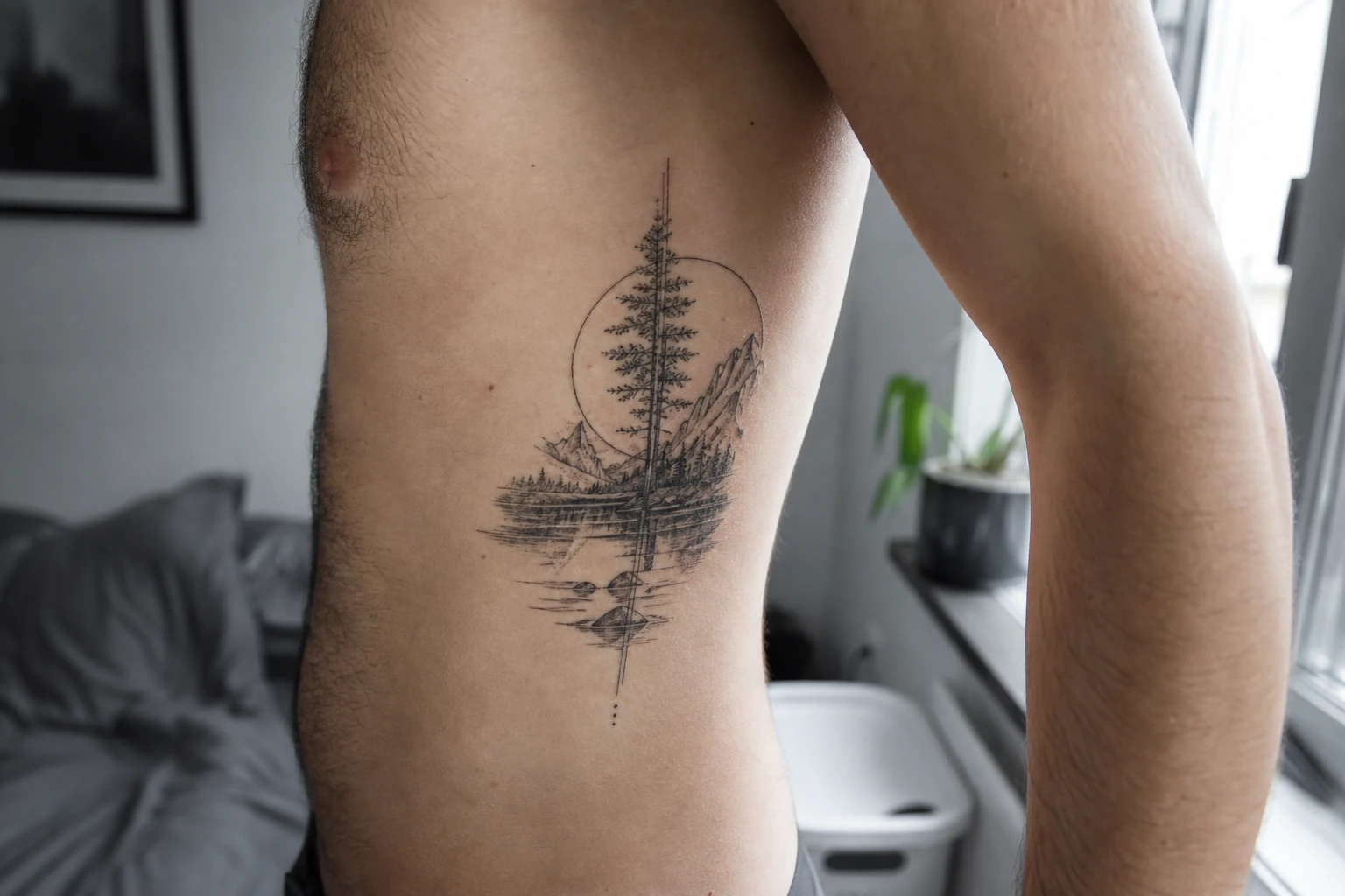 A tattoo undergoing laser removal