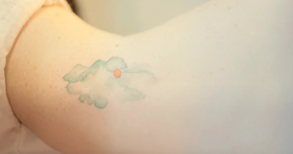 Watercolor Tattoo Removal: Why the Soft Washes Are the Easy Part โ an independent, data-backed guide from Tattoo Removal Guide